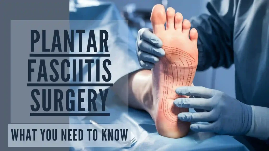 Plantar fasciitis surgery – what you need to know about surgical treatment options, recovery, and success rates for chronic foot pain relief