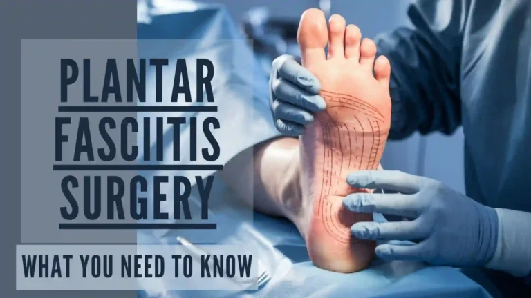 Plantar fasciitis surgery – what you need to know about surgical treatment options, recovery, and success rates for chronic foot pain relief